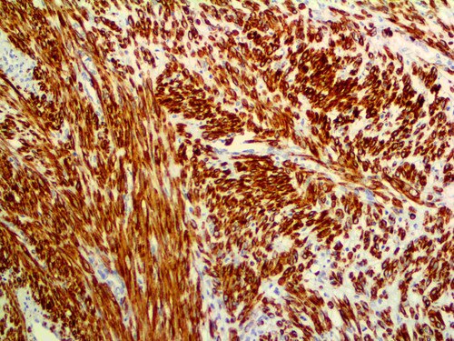 IHC of Desmin Rmab on an FFPE Skeletal Muscle Tissue